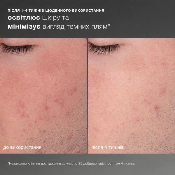 Dermalogica Daily Microfoliant - Щоденний мікрофоліант 40g 2059 фото
