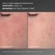 Dermalogica Daily Microfoliant - Щоденний мікрофоліант 40g 2059 фото 3