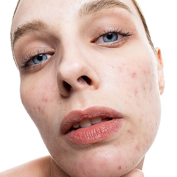 Сироватка освітлююча з азелаїновою кислотою Azelaic & Kojic Advanced Clarifying Serum PAKCS030EN01 фото
