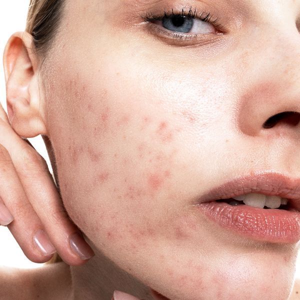 Сироватка освітлююча з азелаїновою кислотою Azelaic & Kojic Advanced Clarifying Serum PAKCS030EN01 фото