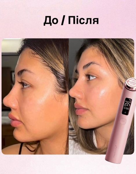Новинка Medicube AGE-R Booster Pro X2 2027 Pink 2005 фото