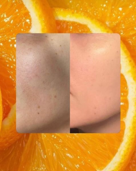 Allies of Skin Сироватка з вітаміном С та клітинами цитрусу Vitamin C 20% & Citrus Cells Advanced Firm & Glow Serum 2027772200 фото