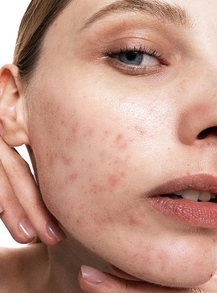 Allies of Skin Денний зволожуючий крем для обличчя Multi Nutrient & Dioic Renewing 50 ml PMNRC050EN01 фото